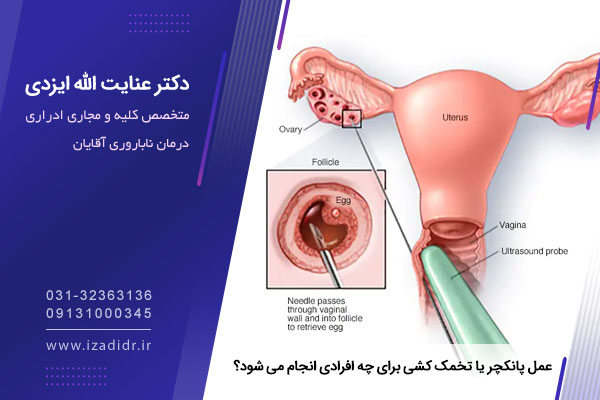 عمل پانکچر یا تخمک کشی برای چه افرادی انجام می شود؟ 