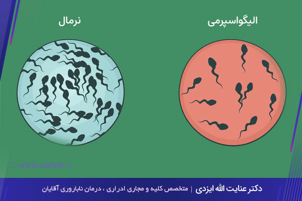 اسپرم صفر یا آزواسپرمی چیست؟