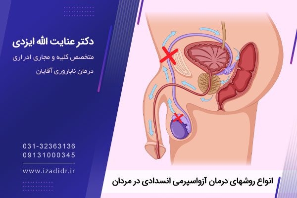 دلایل ابتلا به آزواسپرمی انسدادی