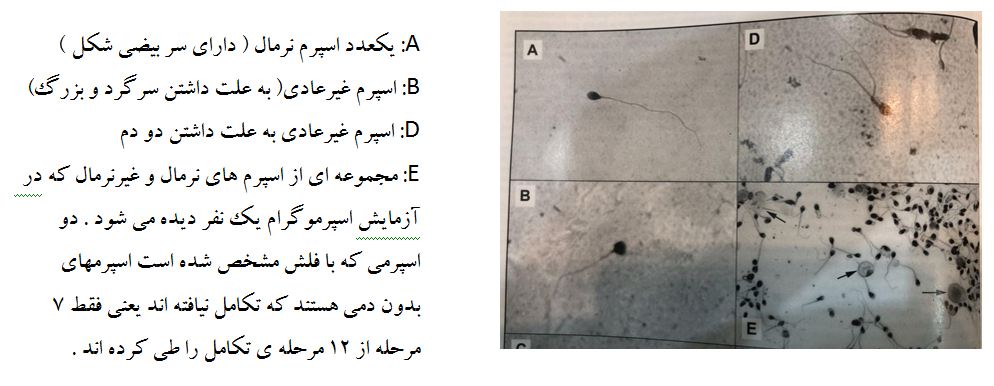 عواملی که باعث تضعیف کیفیت اسپرم می شوند