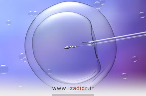 مراقبتهای بعد از آی یو آی | رژیم غذایی، نزدیکی، مدیریت استرس